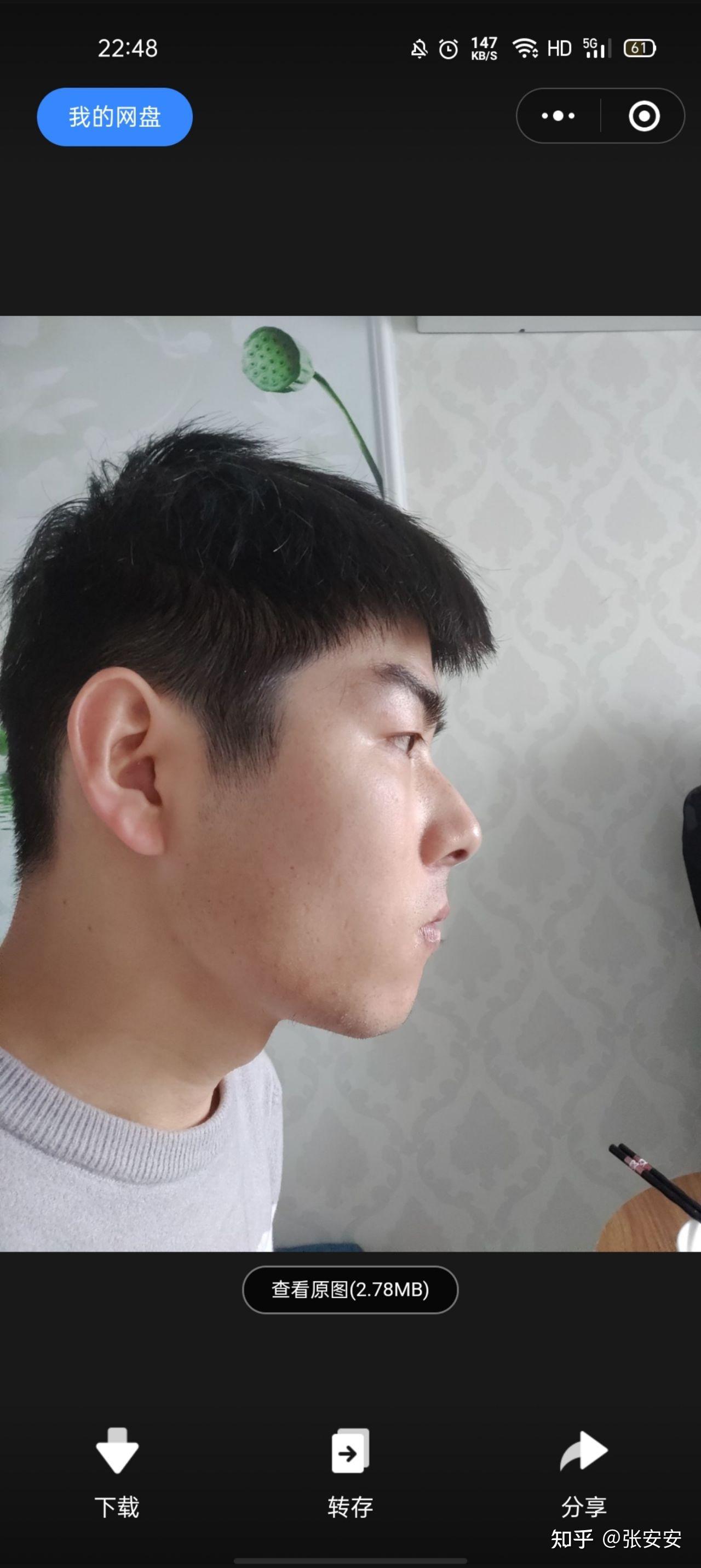 mewing舌头贴上颚有用吗