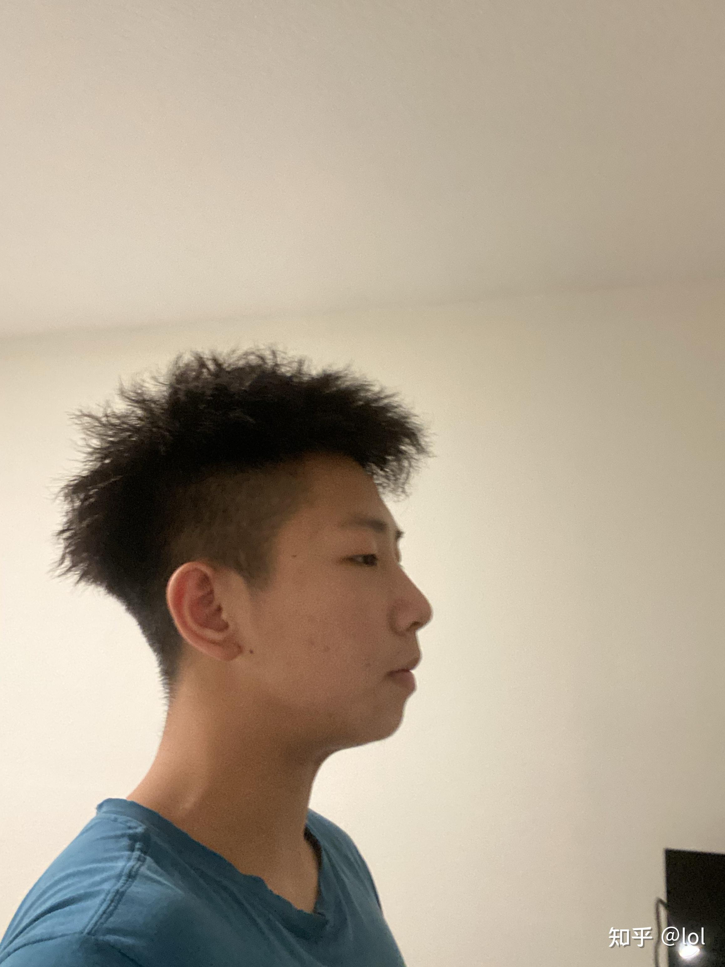 男生,侧脸很丑,因为长相而自卑怎么办? - 知乎