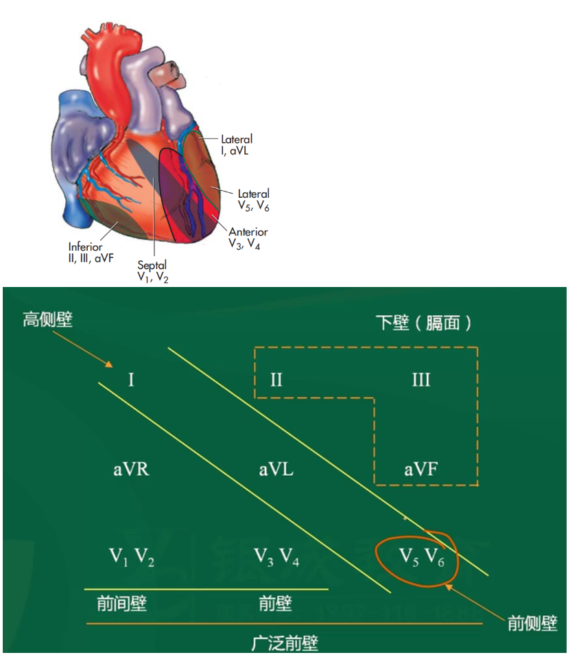 心电图v3r,v4r,v5r位置图片