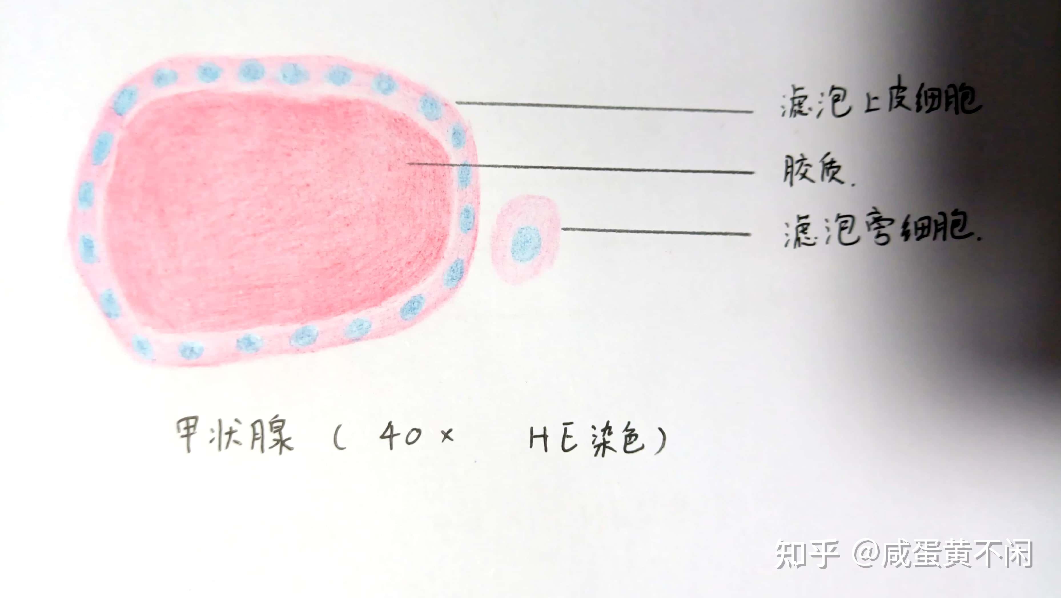 甲状腺切片手绘图图片