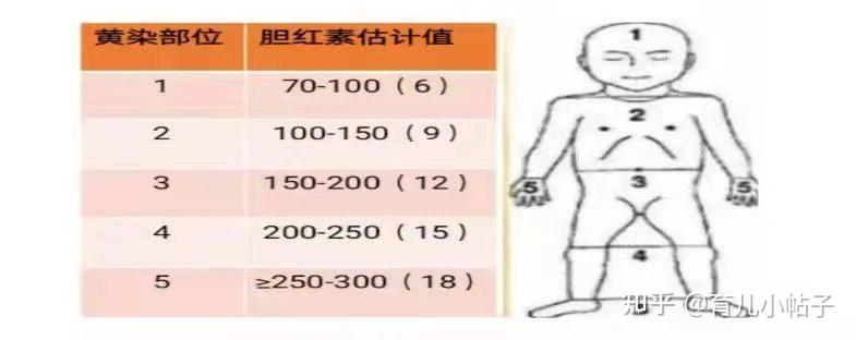 不做“小黄人”——带你正确认识新生儿黄疸 - 知乎