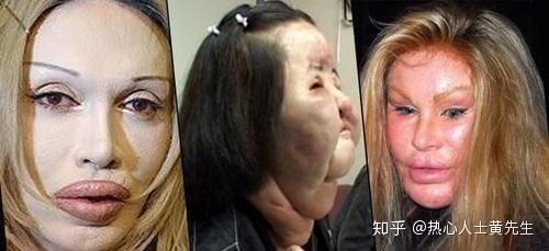 整容存在的风险