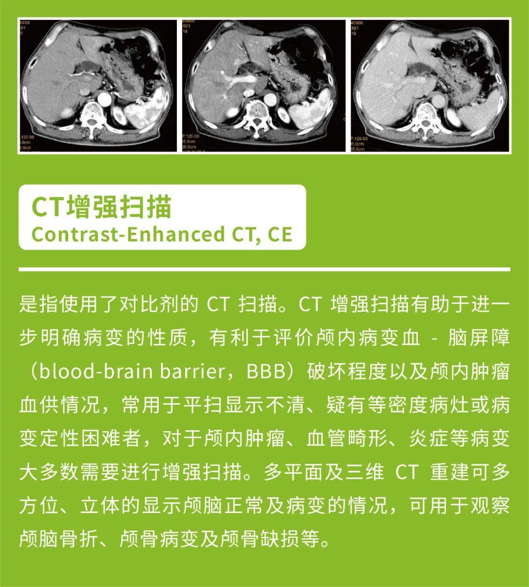 如何快速搞懂ct&mra&dsa这些医学影像检查技术的区别?