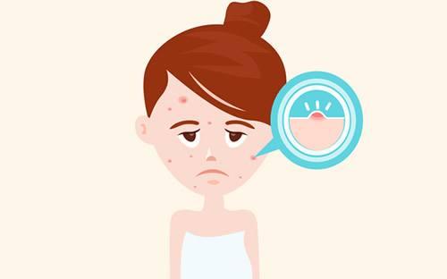 灯下黑是什么病 v2-2497eefef5f831d800cac489becf347b_1440w.jpg?source=172ae18b