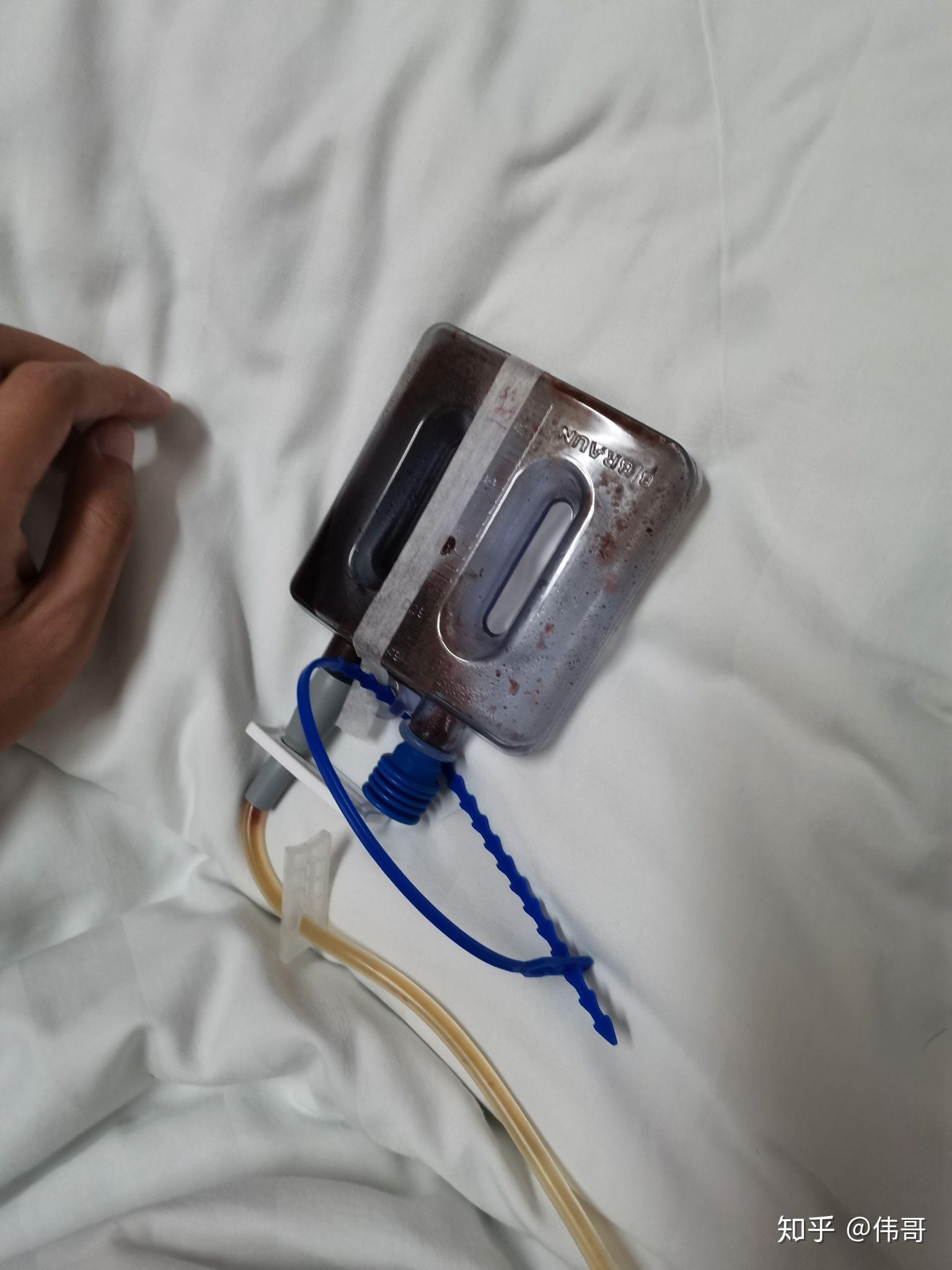 甲状腺结节手术全过程