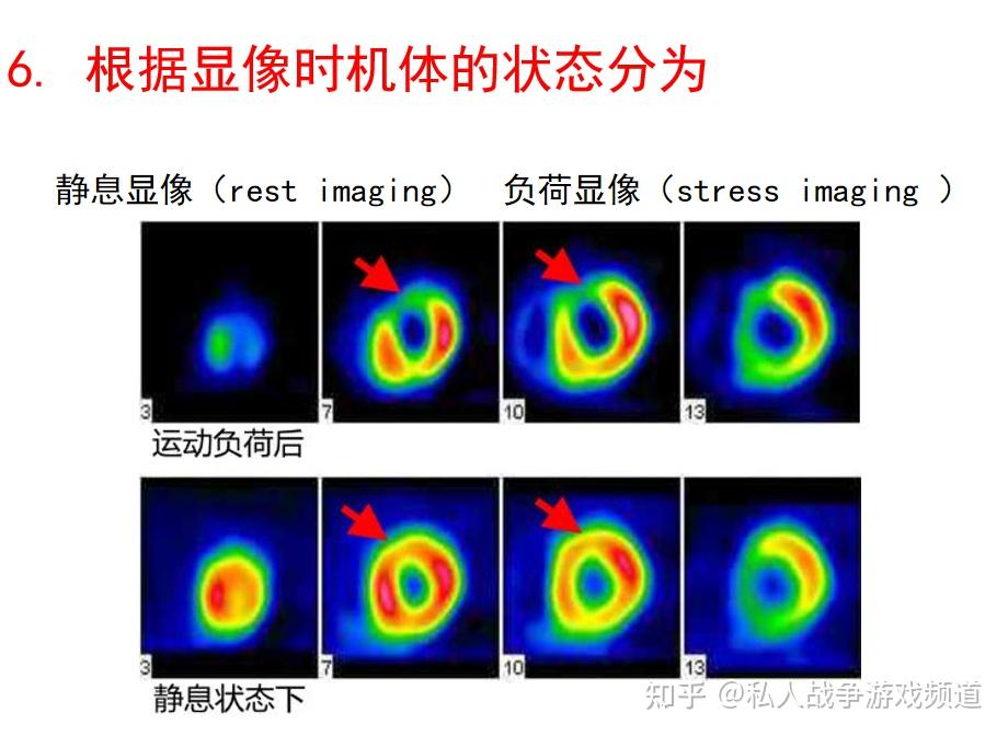 核医学 核医学总论 PPT课件 - 知乎