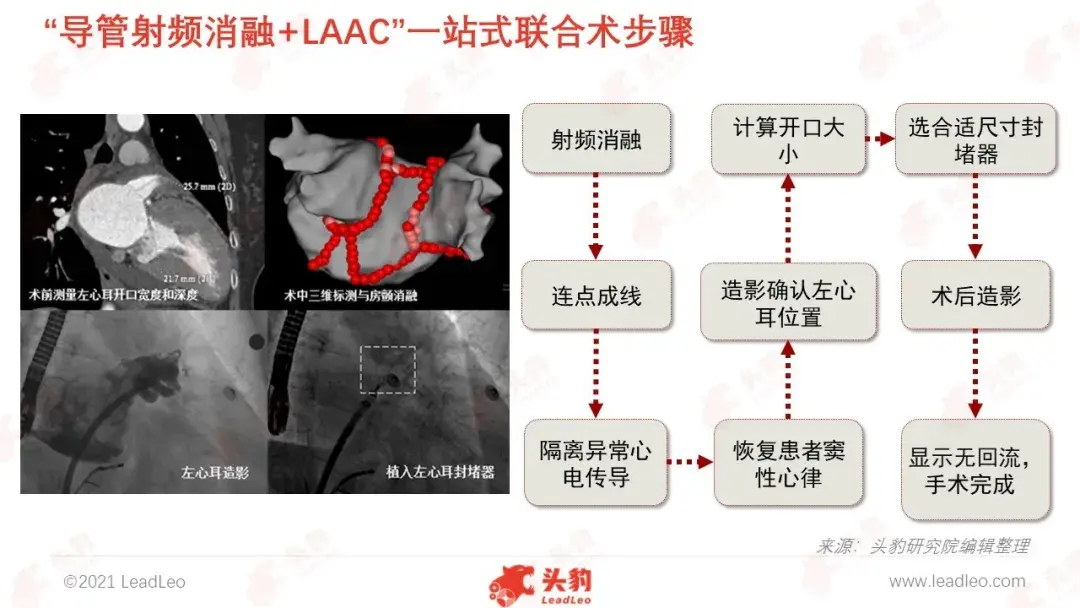 左心耳封堵器擁擠的心血管賽道中新的增長機遇