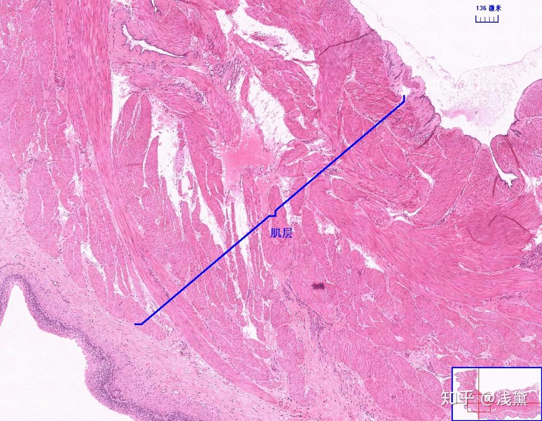5.甲状腺(甲状腺滤泡,滤泡旁细胞)