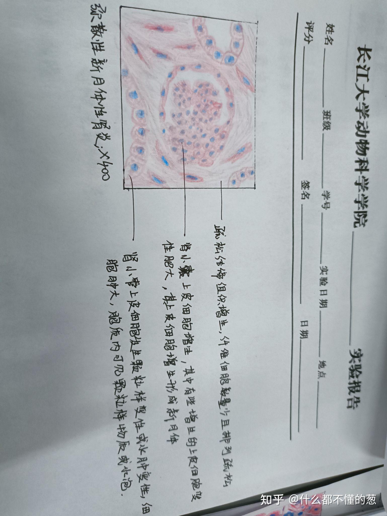 病理切片红蓝铅笔手绘图 知乎