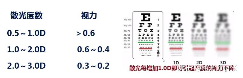 怎样避免散光加深 - 知乎