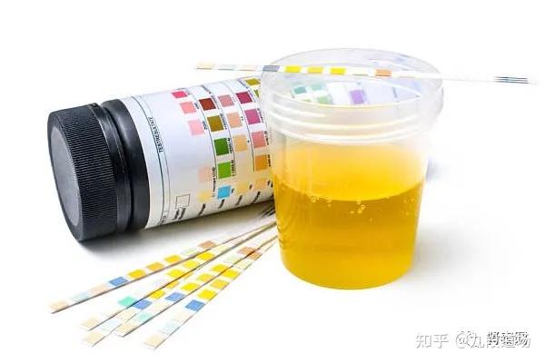 名医 尿常规报告阅读 尿比重的意义 知乎