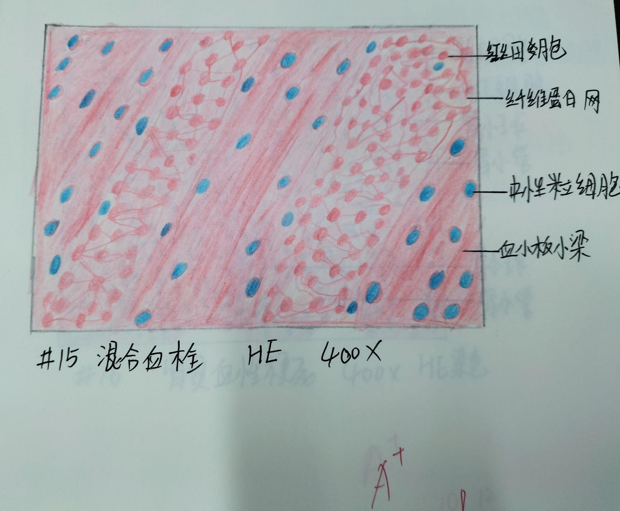 脊髓灰质红蓝铅笔图片