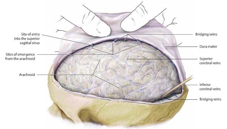剧集doctors里的神经外科知识二动脉瘤性蛛网膜下腔出血asah