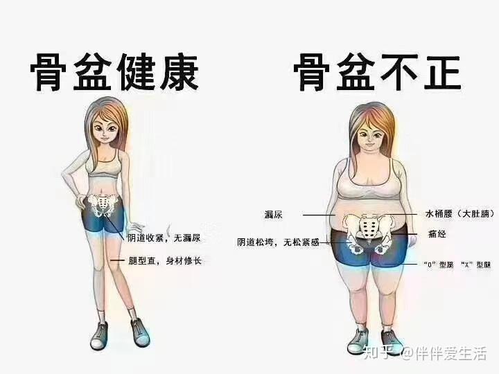 产后身材走样还漏尿,该做盆骨修复么?过来人给你答案!