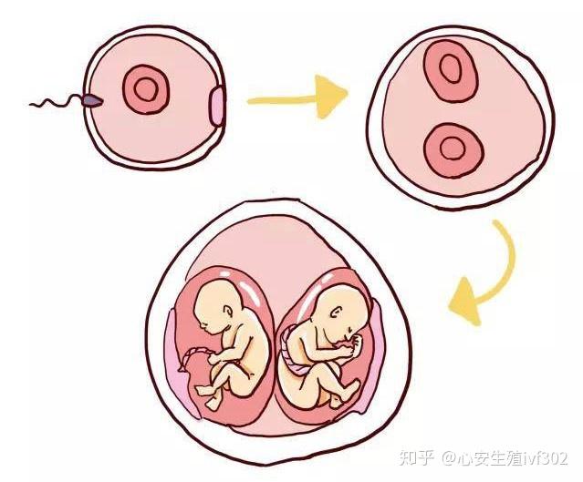 因为试管婴儿是提前促排,在移植的时候会挑选1