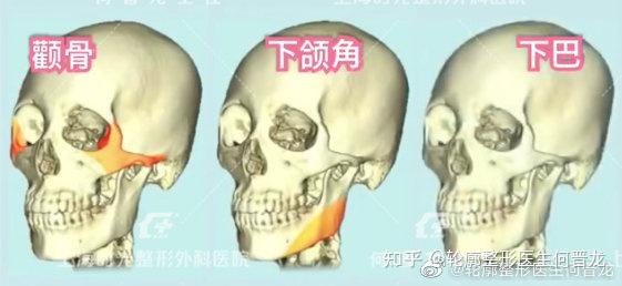 什麼情況下需要做頜面三件套