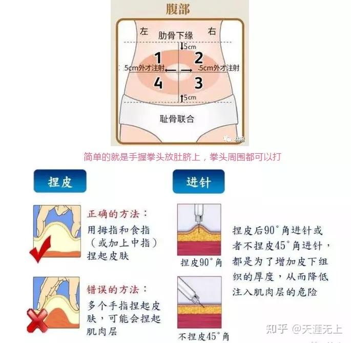 生长激素肚脐注射图图片