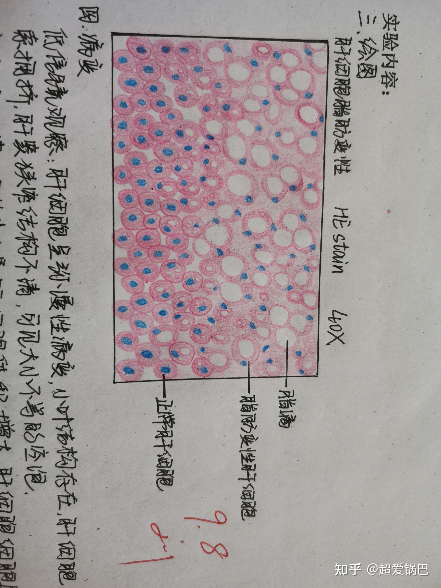 原始红细胞红蓝铅笔图图片