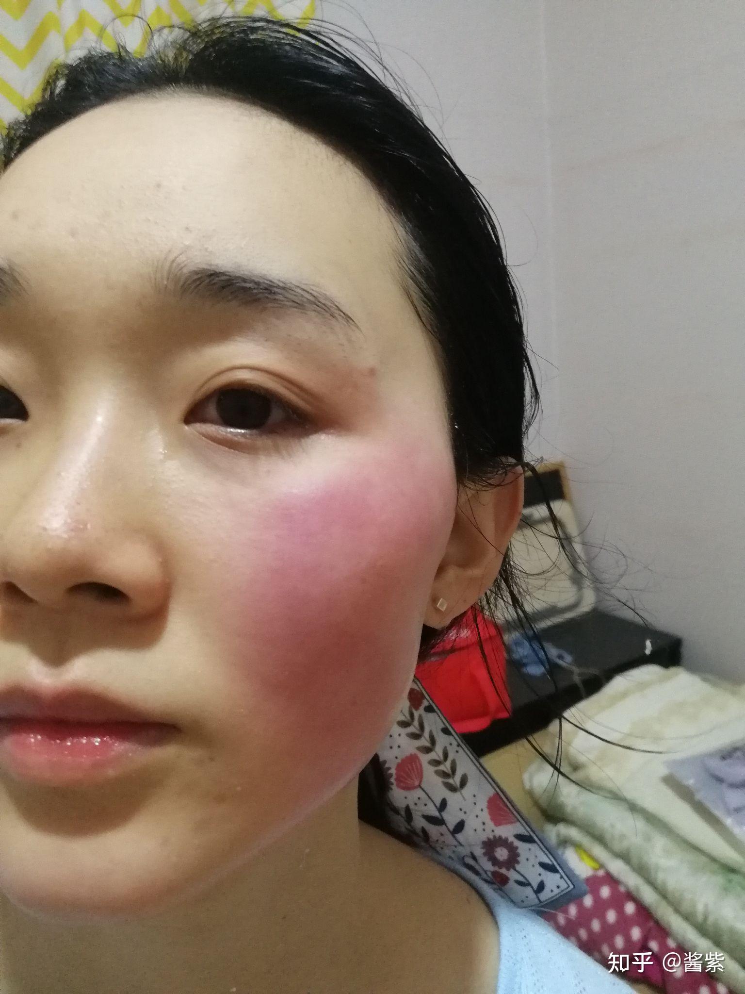 一热整张脸就特别红是怎么了