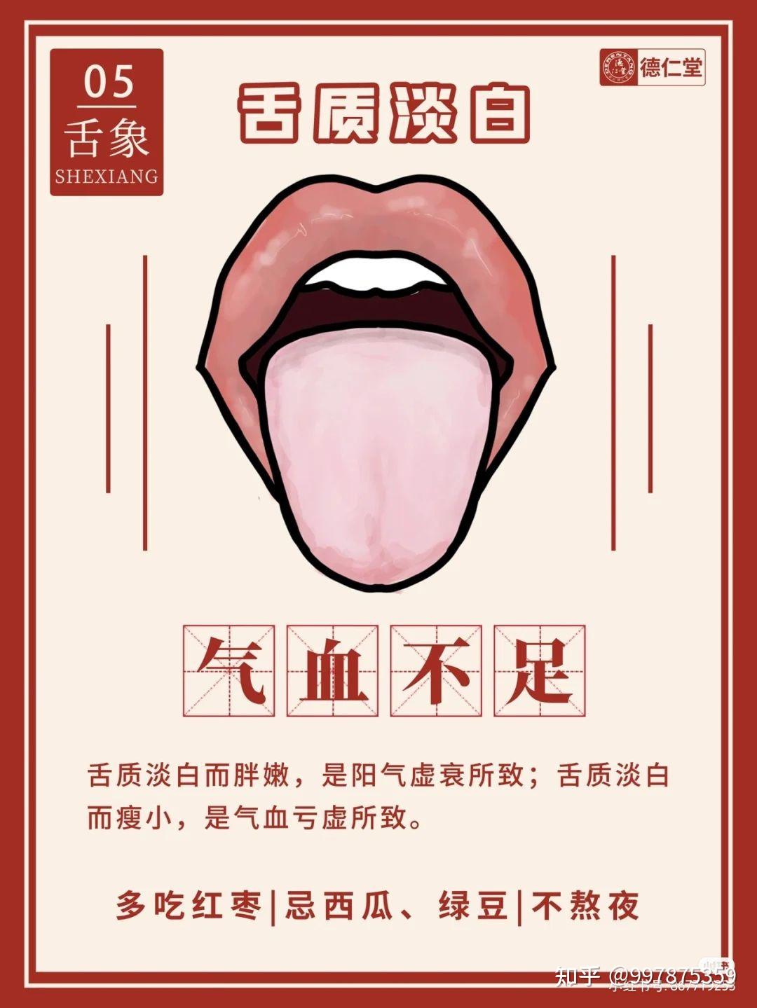 6种中医常见舌象 - 知乎