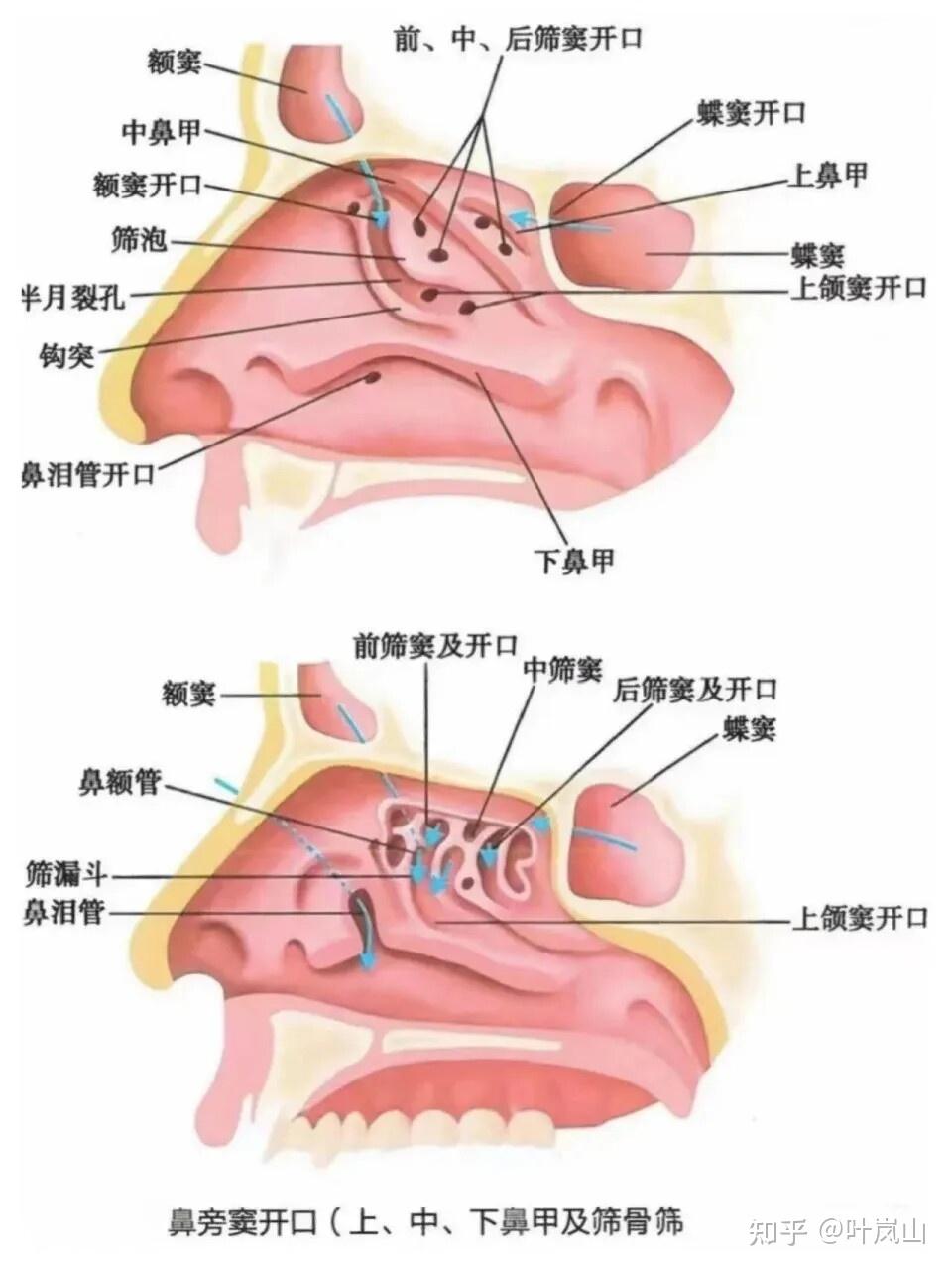脉冲振荡雾化是什么技术?慢性鼻窦炎雾化给药真的会比鼻喷更有效吗?