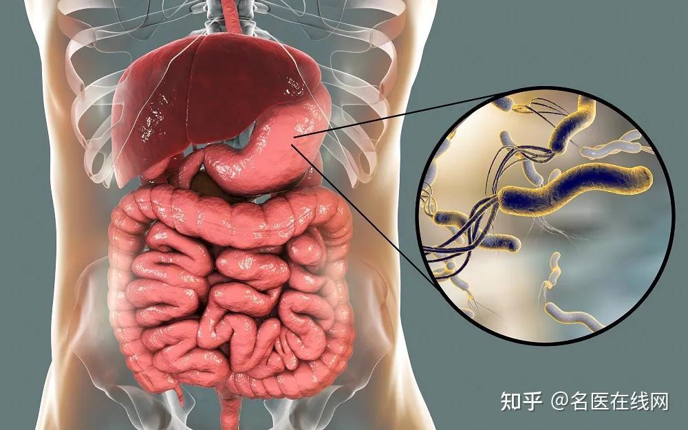 有研究者對口臭同時攜帶幽門螺桿菌的人群進行了根除治療,得到的結果