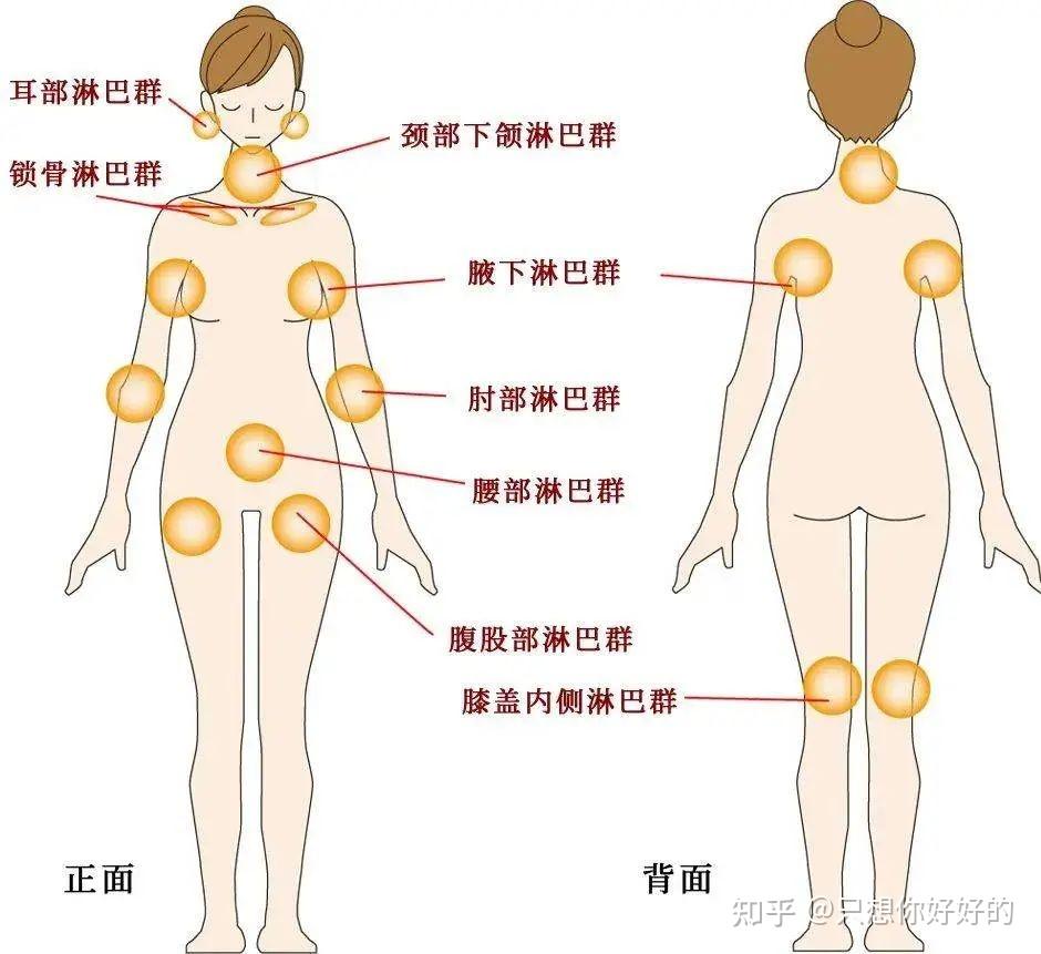 人体五大淋巴位置图图片