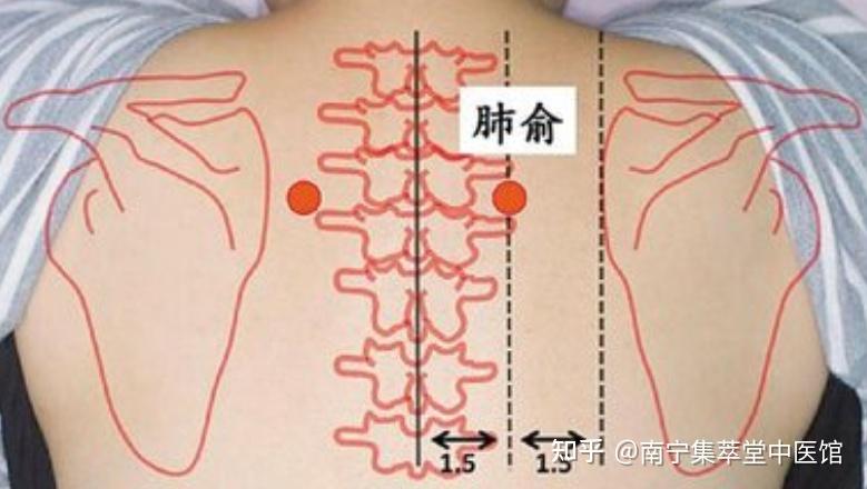 南宁中医:孩子多动有哪些表现?中医如何调护? - 知乎