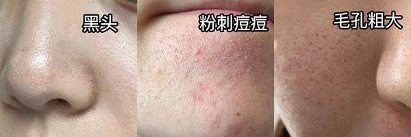 200天试用！5款泥膜大实话版！(科颜氏、ilso、春雨、Ello、宿系之源），干油敏皮真用，激情开麦 - 知乎