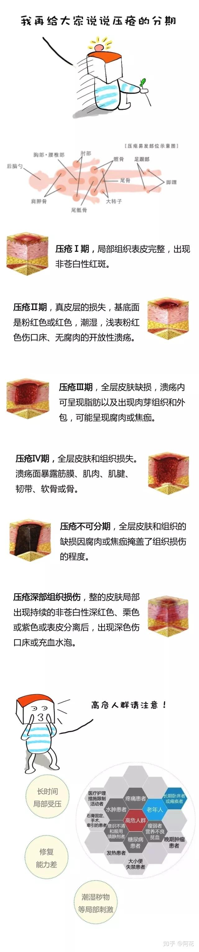 压疮的古往今来 - 知乎