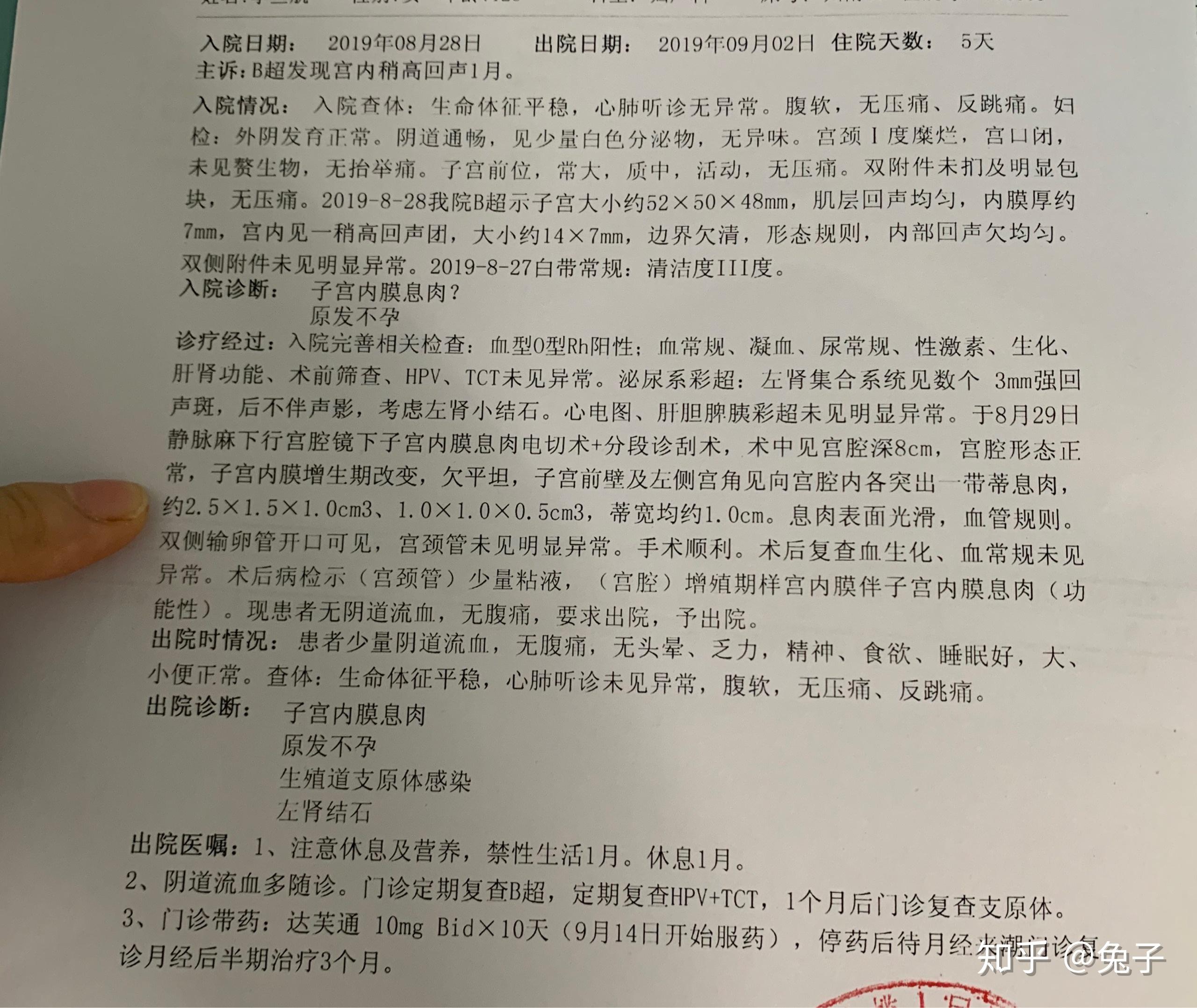 子宫内膜息肉已宫腔镜 - 知乎
