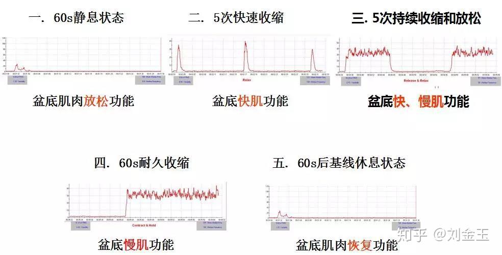 盆底康復從glazer評估開始