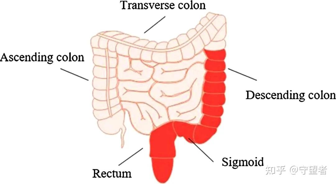 portion represents the lesions, mainly in the descending colon