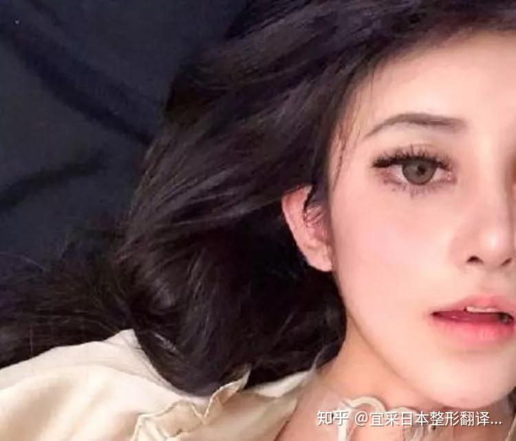 那个15岁就变成蛇精的女孩,现在居然这么美