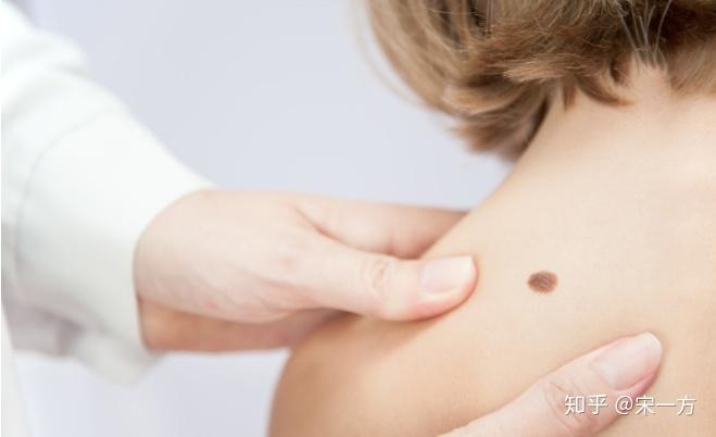 双生痣什么意思女性 v2-27d5bae8623b8613e9719f6acda923ea_r.jpg