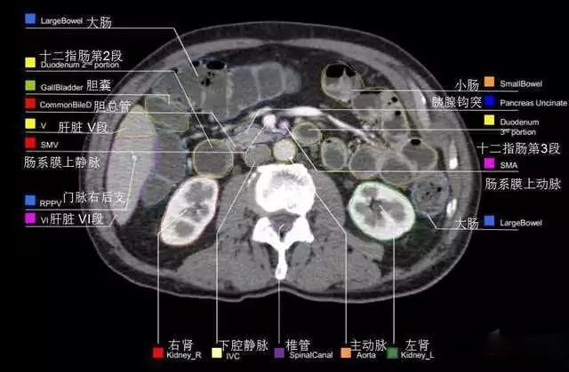 外科医生阅片能力:看完它,再也没有看不懂的腹部CT - 知乎