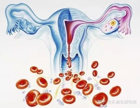 卵巢癌早期诊断仍存在很大困难,哪类高危人群需提前预防? - 知乎