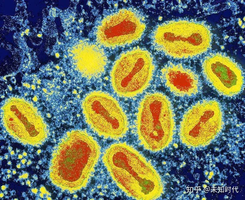 [1] 15世纪 天花(smallpox)