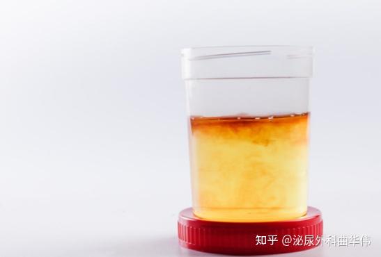 磷酸盐尿图片