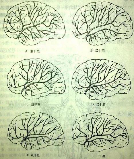 【推荐】颞叶 解剖、血供及影像 - 知乎