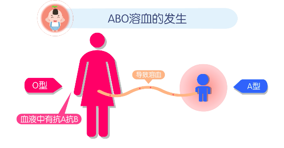 abo溶血和rh溶血