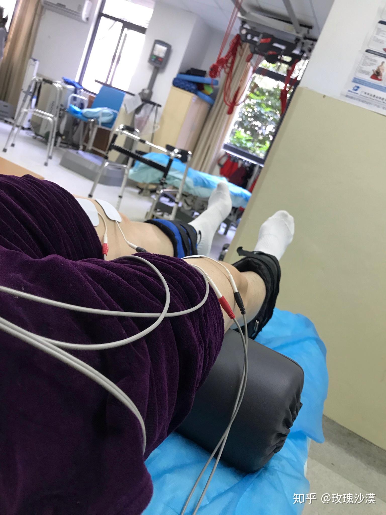 膝盖半月板损伤保守治疗康复医院篇下