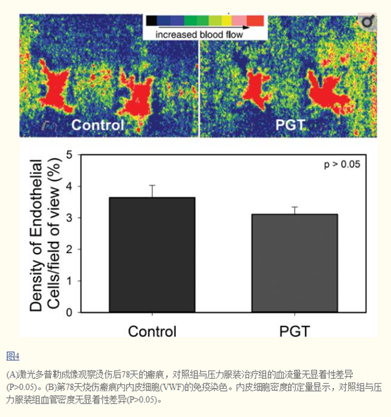 压力衣治疗后烧伤瘢痕的生物力学研究 3 身材总监烧烫伤弹力衣定制 知乎 