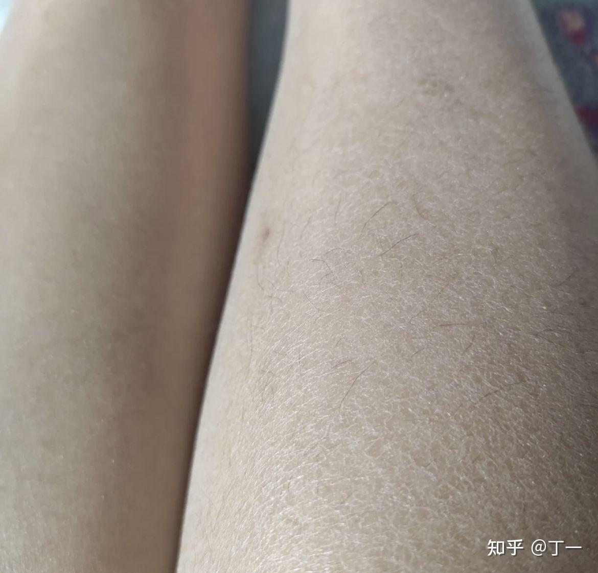 秋冬皮肤干燥起皮,有什么保湿效果好的身体乳推荐吗?