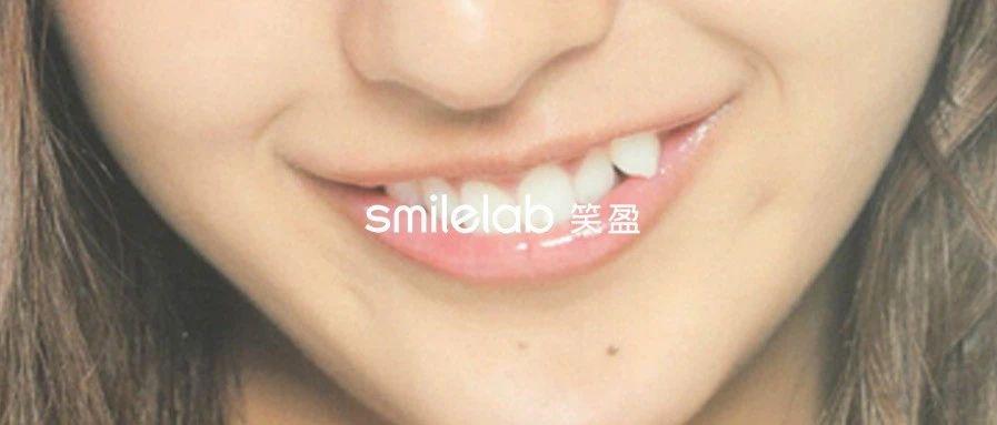 v2-28cdc45856ee876e28bacac0f6b76aff_1440w.jpg?source=172ae18b