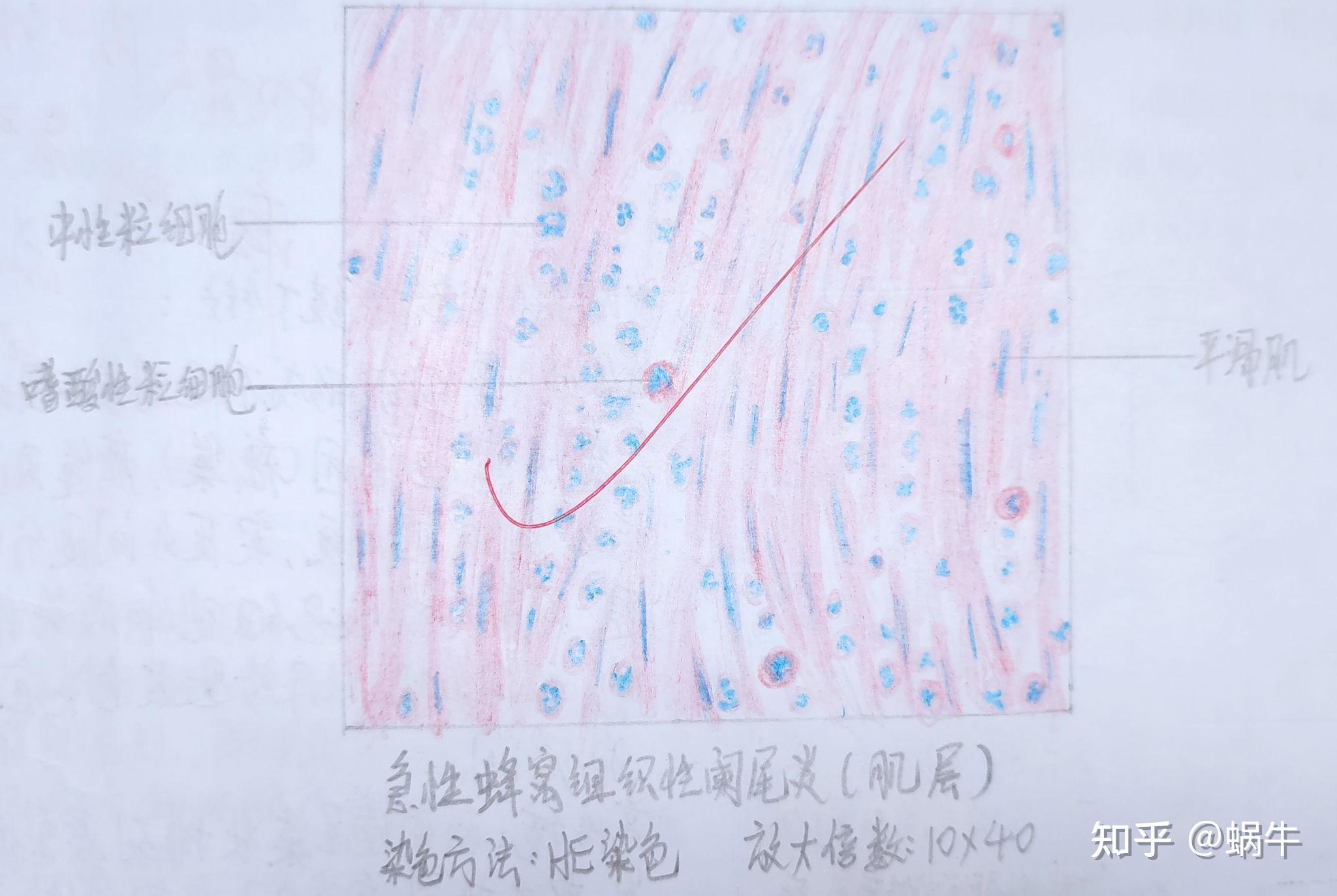病理学实验红蓝铅笔绘图#病理实验画图 - 知乎