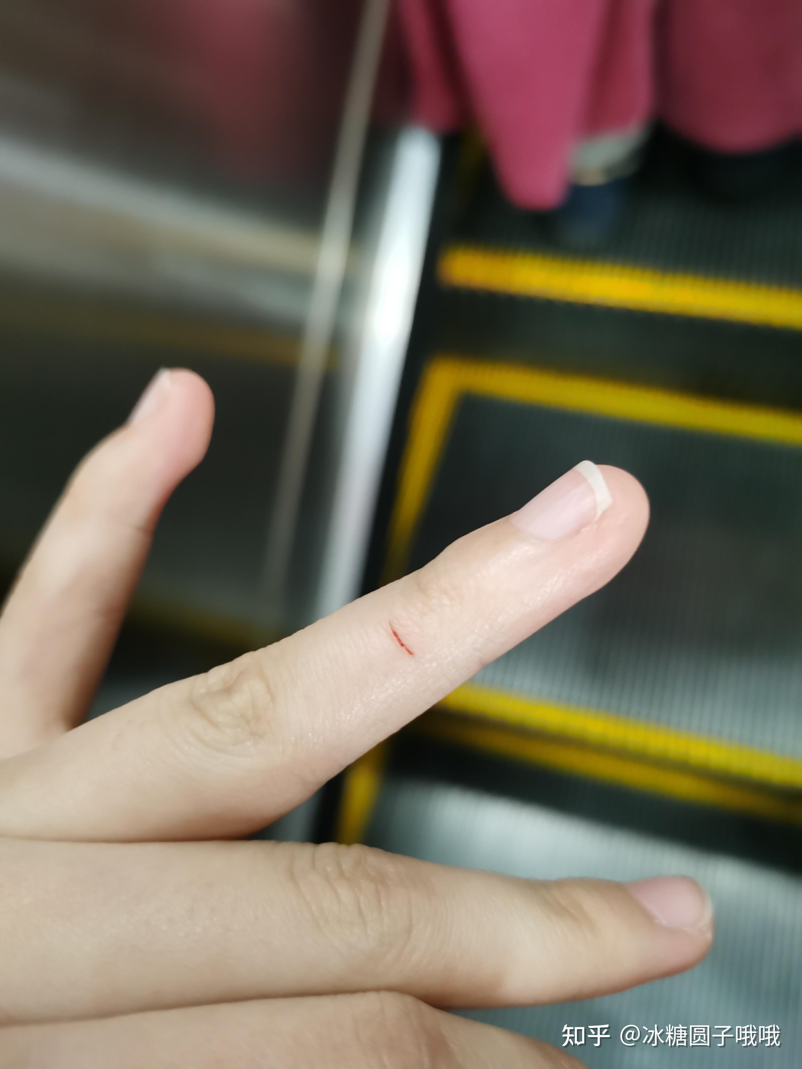 在猫咖被猫咪抓伤了怎么办