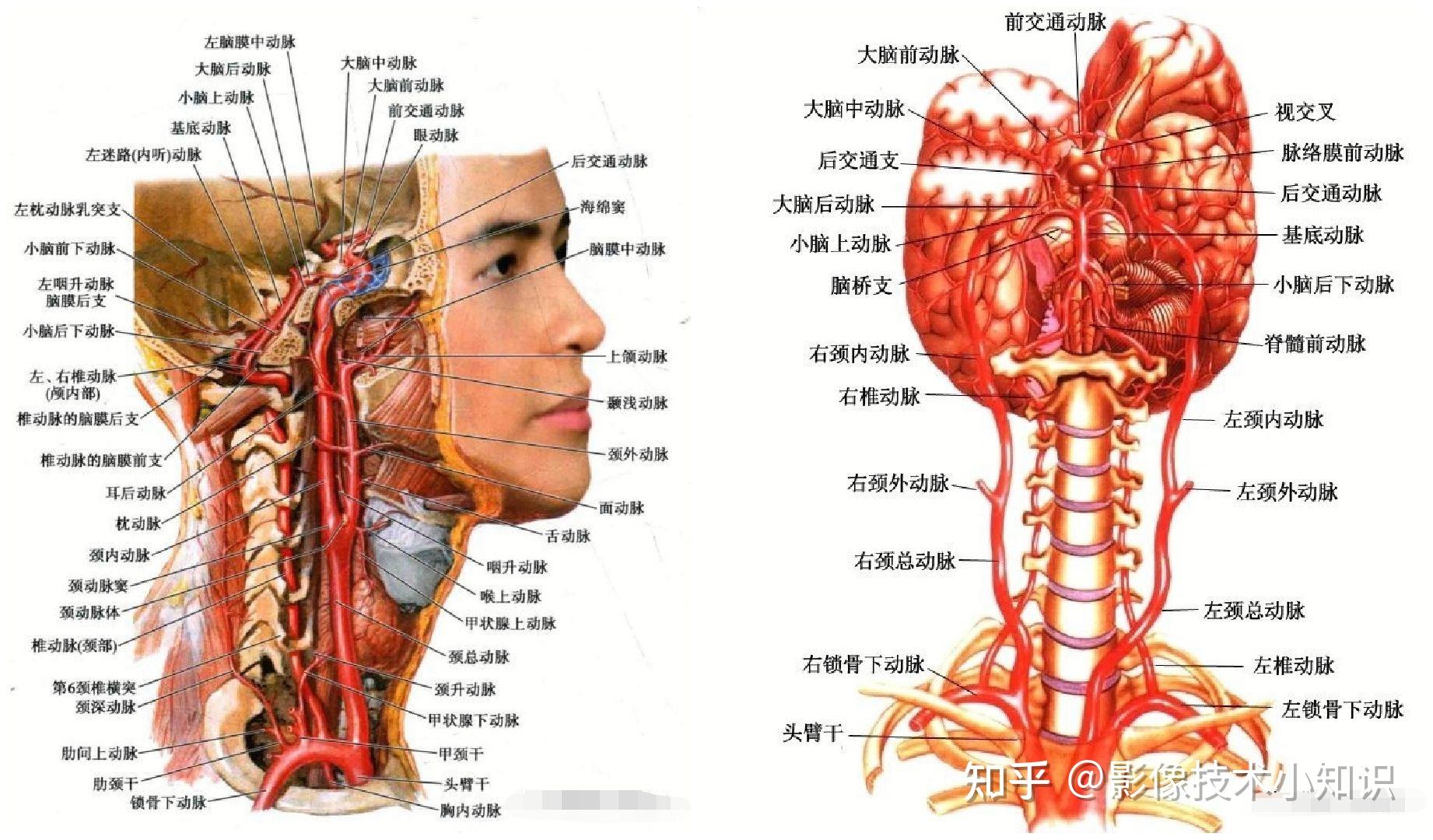 颈动脉管外口的位置图片