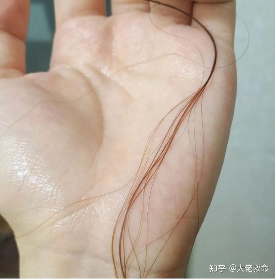 你们是怎么让头发变浓密的? - 知乎