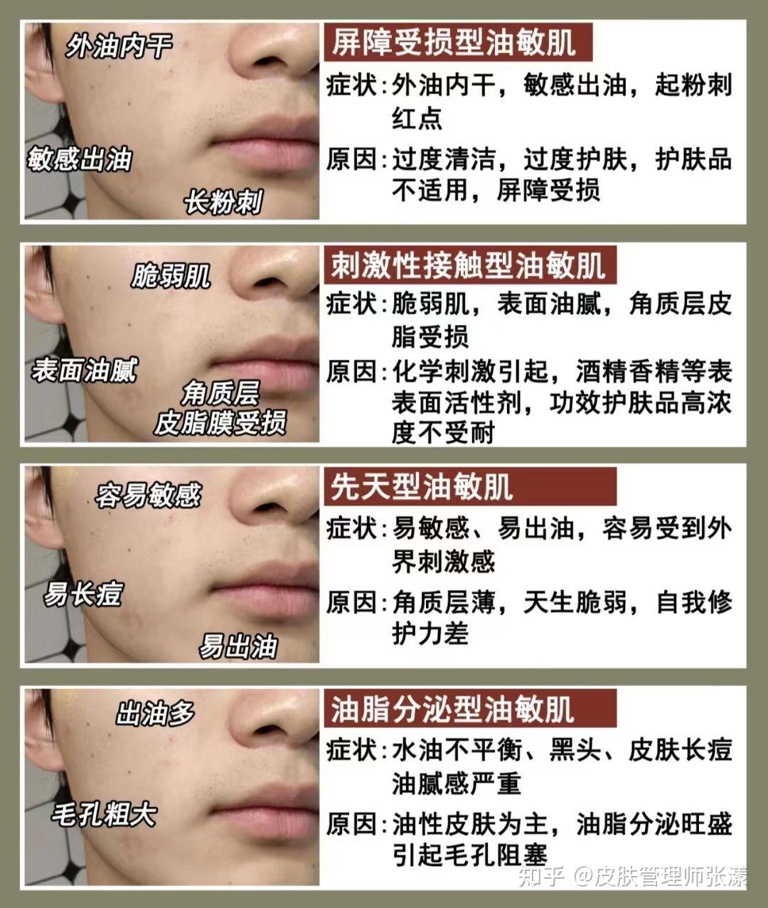 油皮敏感肌适合什么洗面奶？